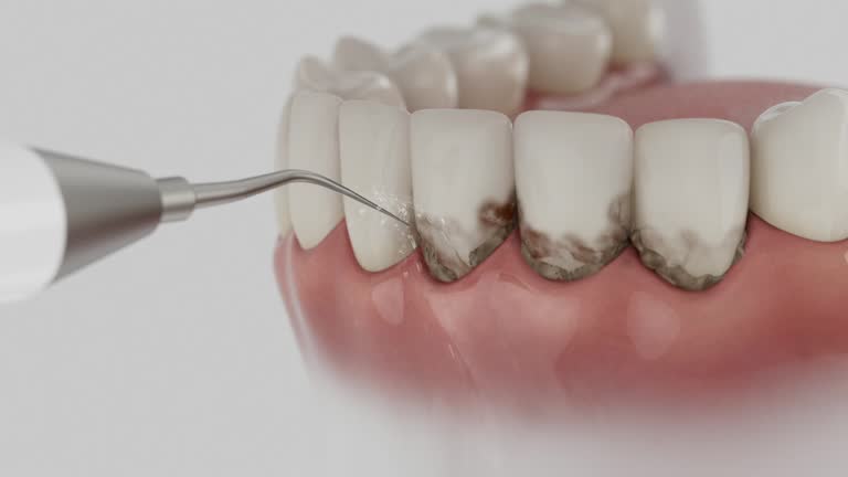 Reliable Dental contractor in Roseville, OH by Dentist Open Now